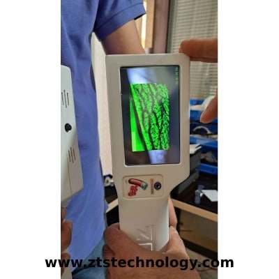 رگ یاب لیزری