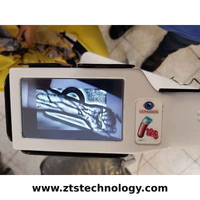 رگ یاب نوزاد